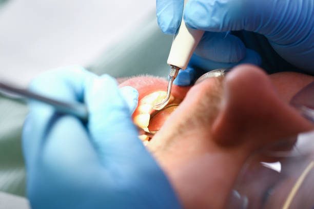 Best Emergency Orthodontic Services in Valparaiso, IN